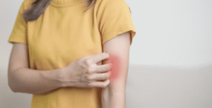 Conoce todo sobre la dermatitis y sus diferentes tipos.