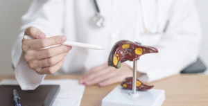 Descubre todo sobre el hígado graso: síntomas, causas y tratamiento. Aprende cómo detectarlo a tiempo, qué hábitos adoptar y cómo prevenirlo.